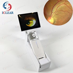 [Hot Item] 2m Pixels LCD HD Ophthalmic Handheld Eye Fundus Camera