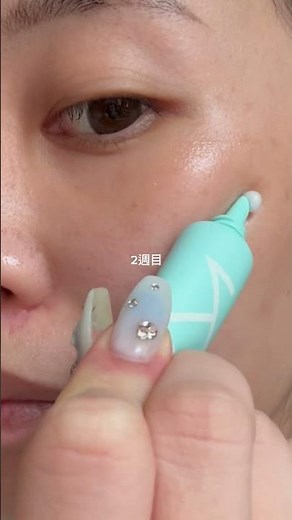 使ったものはプロフにまとめてます‼️ #キテンハイドロキノンクリーム #ハイドロキノンクリーム #肌質改善 #シミケア #色素沈着 # pr