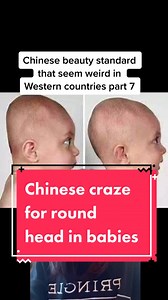 Chinese Plastic Surgery Centers Offering Treatments for Flat Heads