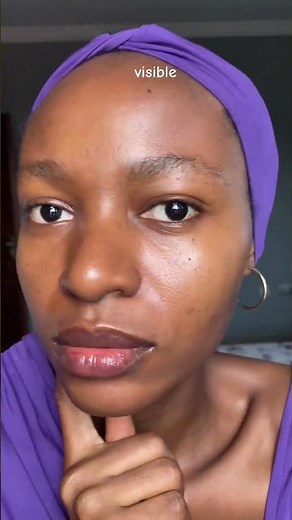 How to get rid of enlarged/open pores #pores #openpores