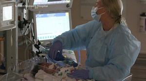 Pediatric respiratory cases stretching hospitals