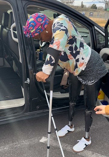 First Walk in My Adjusted Prosthetic Legs