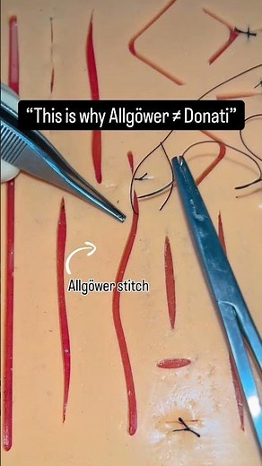 Allgöwer ≠ Donati ❌Vertical mattress sutures explained 🪡#surgeon #surgery