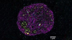Supersize the Cell: Unlocking Secrets of the Genome Through Expansion Microscopy