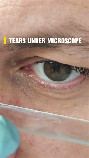 eye drop under microscope..😨😱#shortsfeed#trendingshorts#youtubeshorts#ytshorts#funny#fyp#facts