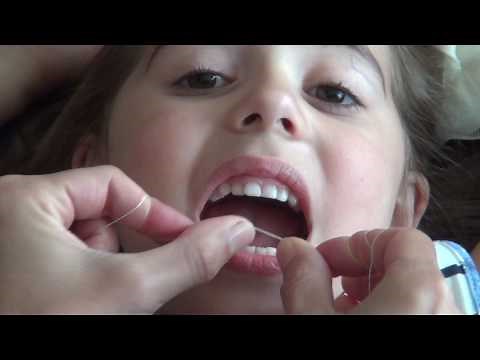 Flossing technique: toddler & child