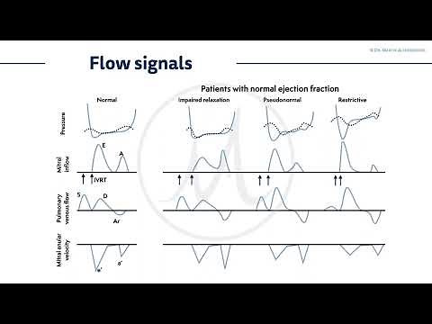 〖Echocardiography〗 Flow signals, mitral valve inflow & tissue doppler, pulmonary valve inflow 🫀