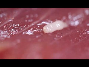 鰹の身に寄生する テンタクラリア