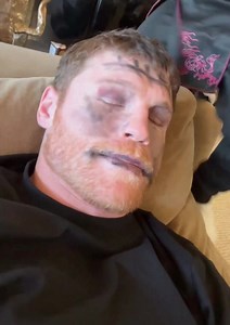 Canelo getting a makeover for Halloween 🎃🤣 | Boxing Exposure