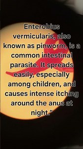 #shorts #parasites #pinworm #enterobius #microbiology #science #medical #health #biology#infection