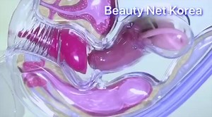 2.9K views · 38 reactions | bnk M cup အသုံးပြုနည်း ✅လက်ကိုသန့်စင်ပါ...