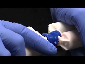 How to reload a dental impression cartridge.