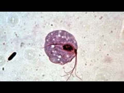 así se miran las trichomonas con microscopio óptico