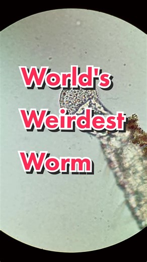 Is this the World's weirdest worm⁉️ 🌏🪱 #TikTokPartner #LearnOnTiktok #microscope #science #worm