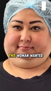 She Had Double Chin Surgery But Wait Until You See Her Jawline Now! Check in Comments 👇👇👇 | Divas & Drama