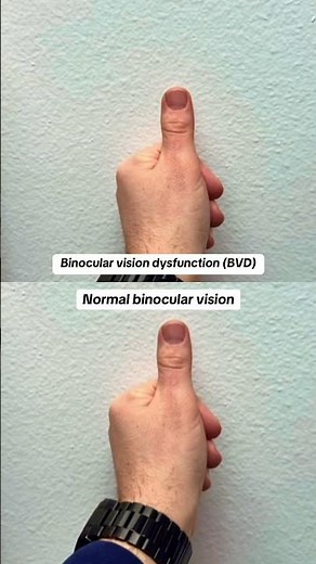 👀 What Normal Vision vs