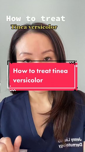 Summer rash!. Tips for treating #tineaversicolor #skintips #skineducation #skinrash #dernatologist #malassezia #antidandrufftreatment