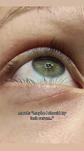 Amazing Results with Lash Serum - Lash Lift Update