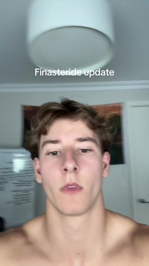 Finasteride Experience: The Good and Bad After 6 Weeks