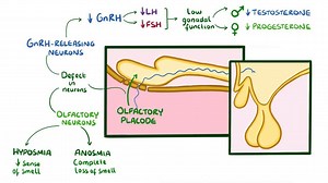 Video: Kallmann syndrome - Video Explanation! | Osmosis | Osmosis