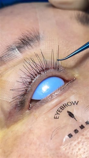 Eyebrows Transplantation Lee on Instagram: "Eyebrows transplant and eyelashes transplant🥰🥰🥰#eyebrowtransplantation #eyebrowtrimming #beauty #植眉 #eyelashtransplant"