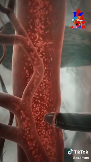 Understanding Malaria: Symptoms, Treatment, and Prevention