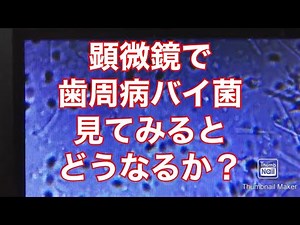 位相差顕微鏡でプラーク 歯周病菌 虫歯菌ばい菌 歯茎の治療 歯垢 予防歯科の重要性 大宮駅西口 鈴木歯科医院