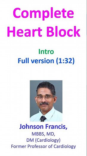 Complete Heart Block
