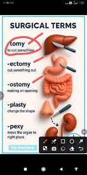 surgical term #coding #codinglife #coder #cpc