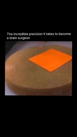 𝗗𝗮𝗶𝗹𝘆 𝗞𝗻𝗼𝘄𝗹𝗲𝗱𝗴𝗲 & 𝗙𝗮𝗰𝘁𝘀 on Instagram: "Robotic surgery systems, like the da Vinci robot, use cameras and ultra-precise robotic arms to help surgeons perform operations with incredible accuracy—reducing pain, blood loss, and recovery time."