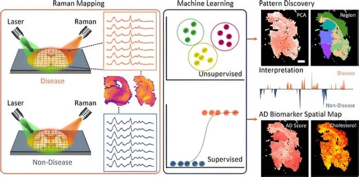 Metabolic clues emerge from a molecular map of Alzheimer's disease