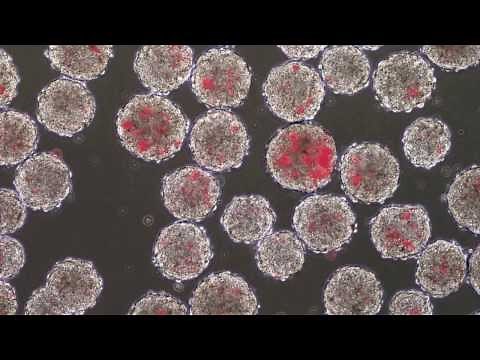 Tipos de Células Madre