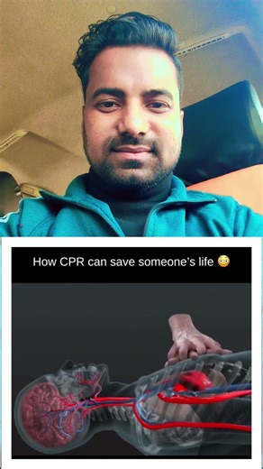 CPR Heart' Attack #letsstudy