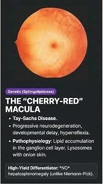 Mastering the Cherry Red Macula USMLE High Yield Tay Sachs Niemann Pick Disease Step 1 Biochemistry