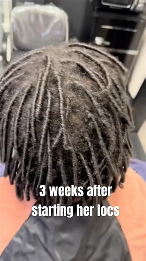 3 Weeks After Starting Starter Locs… First Retwist 👀