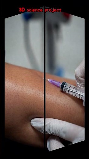 Ankle Injection Treatment | Swelling & Pain Relief Procedure | Medical Procedure Explained