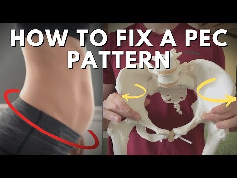 How to Fix a PEC Pattern + Relationships to the PRI Left AIC