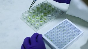 Forward Genetic Screen Using Transgenic Calcium Reporter Aequorin to Identify Novel Targets in Calcium Signaling
