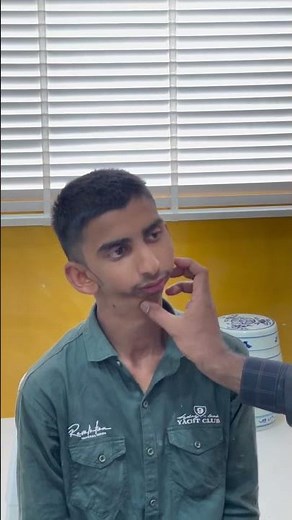 Restricted mouth opening | TMJ Ankylosis case