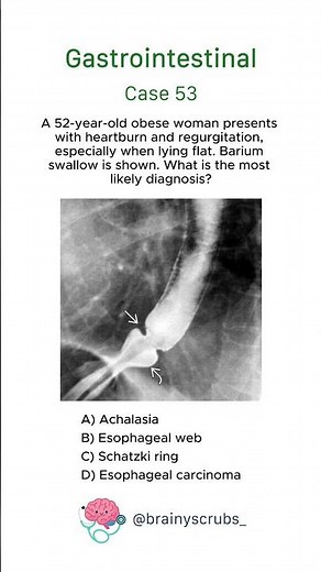 Gastrointestinal - Case 53