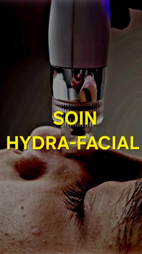 Before And After The HYDRA-FACIAL ✨👌 #salon_capello #skincareroutine #Skincare #hydrafacial #hydratedskin | salon_capello