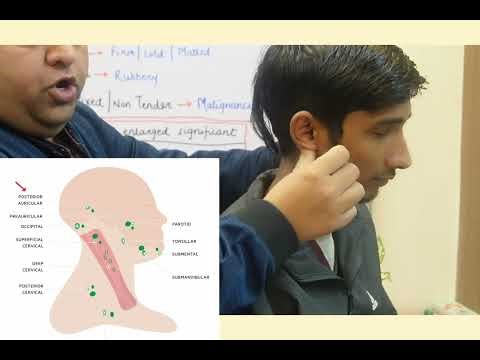 Lymphadenopathy Examination for medical students (MBBS,BAMS,MD) By Dr. Sorabh KGMU #lymphadenopathy