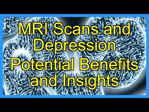 MRI Scans and Depression Potential Benefits and Insights