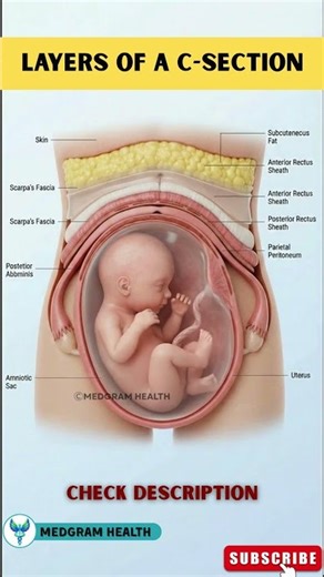 What Are the 7 Layers Cut in a C Section?