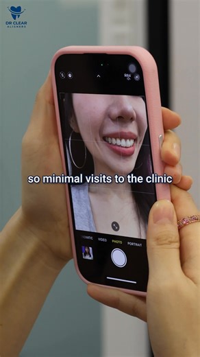 Imagine smiling confidently — just 6 months from now. ✨ With Dr Clear Aligners, you can straighten your teeth discreetly and comfortably, without the look or hassle of metal braces. No brackets. No pain. Just real results — and a reason to smile every day 😁 ✅ Invisible and non-invasive ✅ Precision with advanced 3D technology ✅ Predict your smile with AI ✅ See real results in 6–9 months ✅ Track your progress remotely Take the first step and start your transformation today! 📩 | Dr Clear Aligners