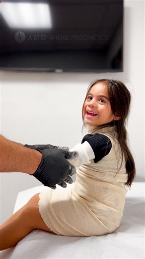 11K views · 8K reactions | An adorable behind-the-scenes moment!  Luna, a below-elbow amputee, is being cast for her second prosthetic arm. She received her first, a hyper-realistic silicone prosthesis, at just two years old. Now at four, she’s excited to get her first myoelectric prosthetic arm. She truly lights up the office whenever she’s in! 料殺 #prostheticarm #limblossawareness #luckyfin | A Step Ahead Prosthetics | Facebook