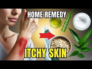 7 Ultimate Home Remedy For Skin Allergy Itching That Actually Works