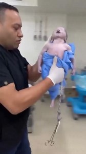 La reanimación neonatal avanzada se aplica cuando un recién nacido no respira, no llora o presenta bradicardia severa al nacer y no responde a las maniobras iniciales. Su objetivo es restablecer la ventilación, oxigenación y circulación de forma inmediata. Incluye: 🔹 Ventilación con presión positiva 🔹 Intubación endotraqueal 🔹 Compresiones torácicas 🔹 Administración de medicamentos 🔹 Monitorización continua Cada segundo cuenta. Una intervención rápida, coordinada y entrenada puede marcar la