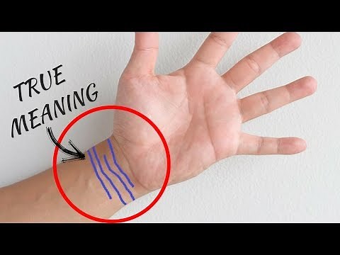 Do You Know The True Meaning Of Wrist Lines In Your Hands?-Bracelet Lines In Palmistry