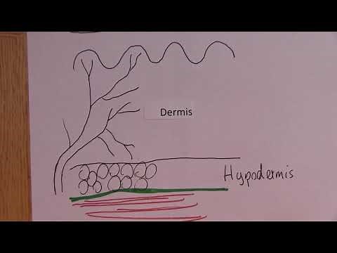 Burns 4, Classification of burns